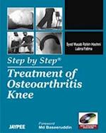 Step by Step: Treatment of Osteoarthritis Knee