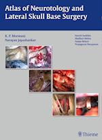 Atlas of Neurotology and Lateral Skull Base Surgery