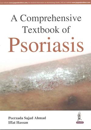 A Comprehensive Textbook of Psoriasis