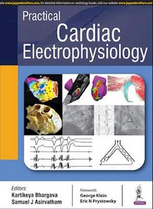 Practical Cardiac Electrophysiology