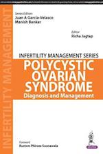Infertility Management Series: Polycystic Ovaries