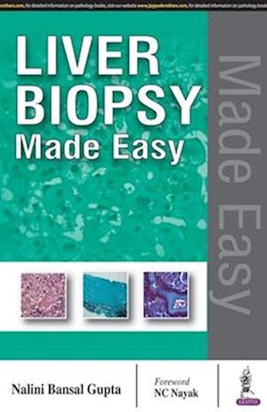 Liver Biopsy Made Easy