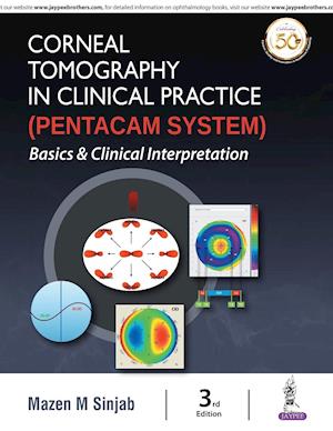 Corneal Tomography in Clinical Practice (Pentacam System)