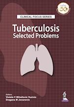 Clinical Focus Series: Tuberculosis