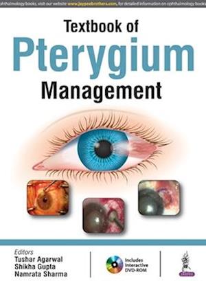 Textbook of Pterygium Management