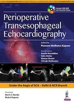 Perioperative Transeasophageal Echocardiography