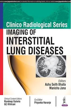 Clinico Radiological Series: Imaging of Interstitial Lung Diseases