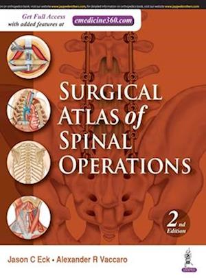 Surgical Atlas of Spinal Operations