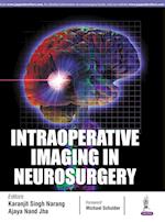 Intraoperative Imaging in Neurosurgery