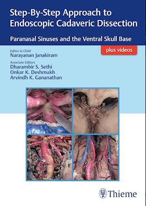 Step-By-Step Approach to Endoscopic Cadaveric Dissection, ed 1