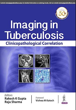 Imaging in Tuberculosis