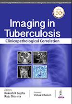 Imaging in Tuberculosis