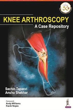 Knee Arthroscopy