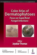 Color Atlas of Dermatophytoses