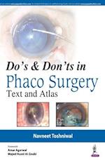Do's & Dont's in Phaco Surgery
