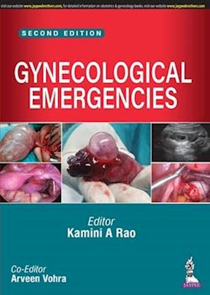 Gynecological Emergencies