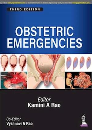 Obstetric Emergencies