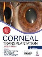 Corneal Transplantation