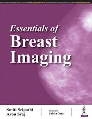 Essentials of Breast Imaging