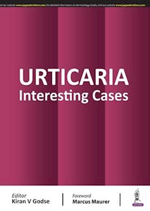 Urticaria : Interesting Cases