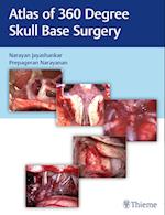 Atlas of 360 Degree Skull Base Surgery