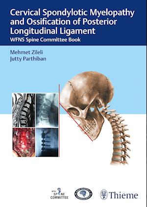 Cervical Spondylotic Myelopathy and Ossification of Posterior Longitudinal Ligament