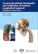 Cervical Spondylotic Myelopathy and Ossification of Posterior Longitudinal Ligament