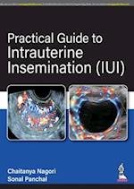 Practical Guide to Intrauterine Insemination (IUI)