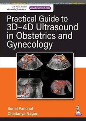 Practical Guide to 3D-4D Ultrasound in Obstetrics and Gynecology