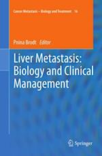 Liver Metastasis: Biology and Clinical Management