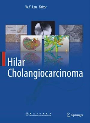 Hilar Cholangiocarcinoma