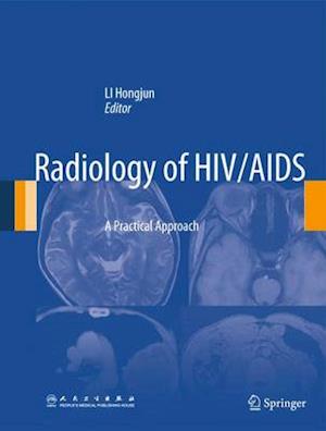 Radiology of HIV/AIDS