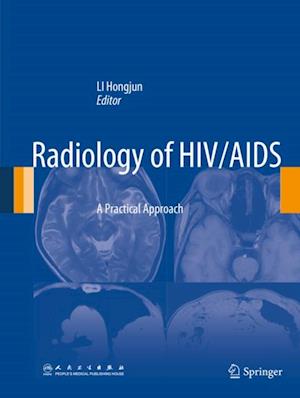 Radiology of HIV/AIDS