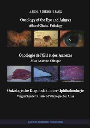 Oncology of the Eye and Adnexa / Oncologie de l' il et des Annexes / Onkologische Diagnostik in der Ophthalmologie