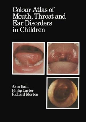 Colour Atlas of Mouth, Throat and Ear Disorders in Children