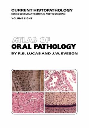 Atlas of Oral Pathology