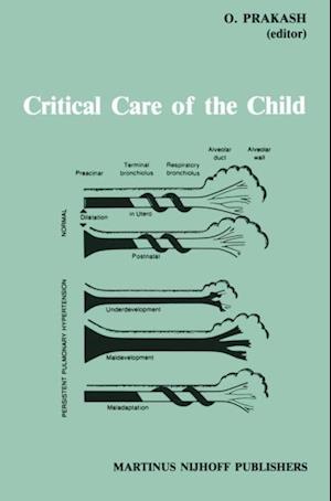 Critical Care of the Child