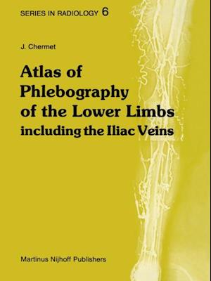 Atlas of Phlebography of the Lower Limbs