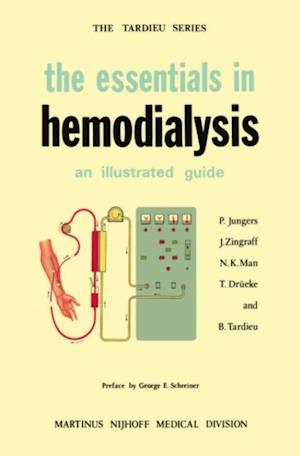 Essentials in Hemodialysis