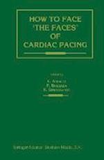 How to face ‘the faces’ of CARDIAC PACING