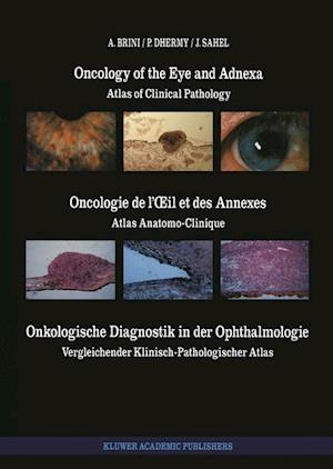 Oncology of the Eye and Adnexa / Oncologie de l’Œil et des Annexes / Onkologische Diagnostik in der Ophthalmologie