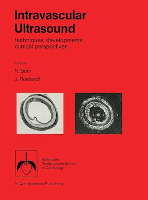 Intravascular ultrasound