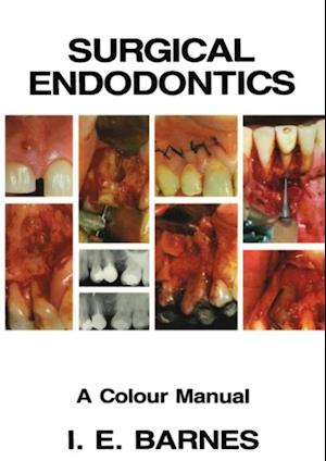 Surgical Endodontics