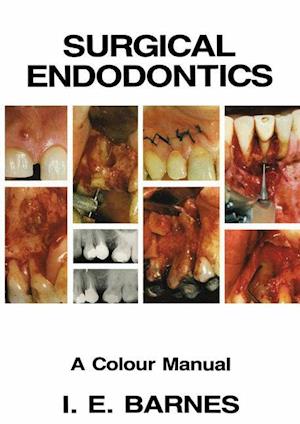 Surgical Endodontics