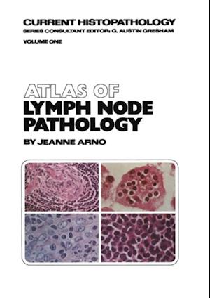 Atlas of Lymph Node Pathology