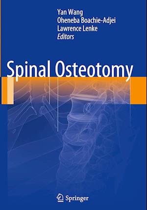 Spinal Osteotomy