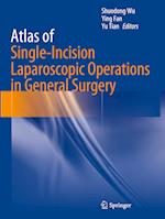 Atlas of Single-Incision Laparoscopic Operations in General Surgery