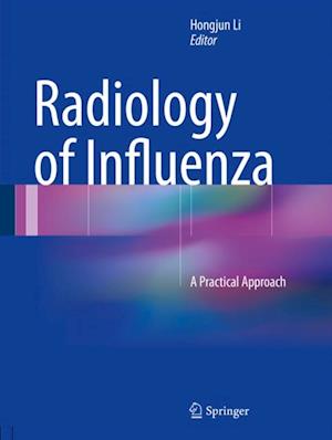 Radiology of Influenza