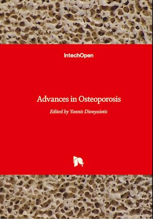 Advances in Osteoporosis