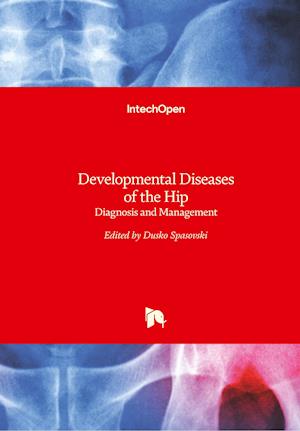 Developmental Diseases of the Hip